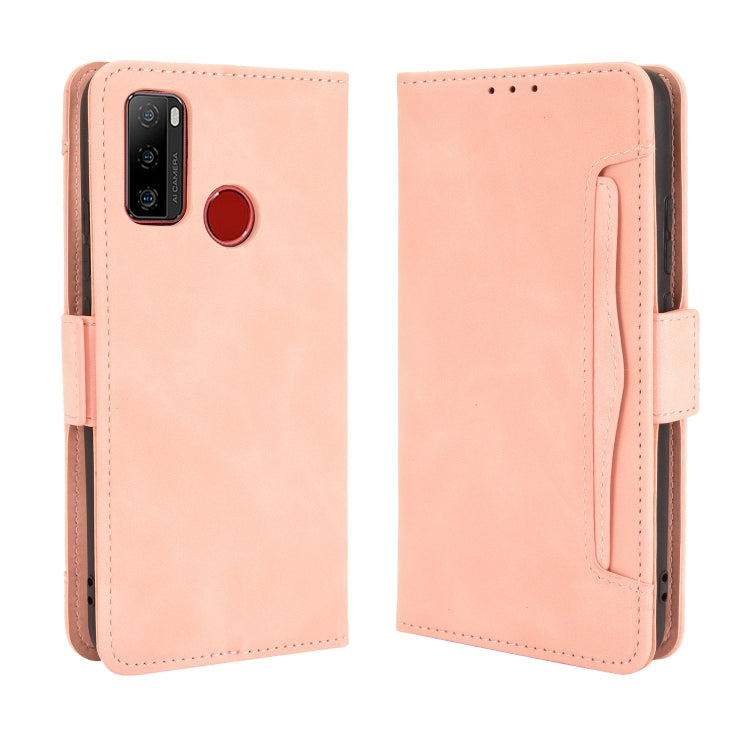 For Ulefone Note 10 Skin Feel Calf Pattern Horizontal Flip Leather Case with Holder & Card Slots & Photo Frame(Pink) - Ulefone Cases by PMC Jewellery | Online Shopping South Africa | PMC Jewellery | Buy Now Pay Later Mobicred