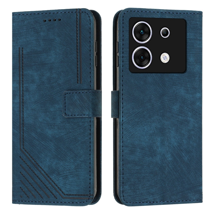 For Infinix Zero 30 5G Skin Feel Stripe Pattern Leather Phone Case with Lanyard(Blue) - Infinix Cases by PMC TechLife | Online Shopping South Africa | PMC TechLife | Buy Now Pay Later Mobicred
