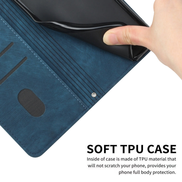 For Infinix Zero 30 5G Skin Feel Stripe Pattern Leather Phone Case with Lanyard(Blue) - Infinix Cases by PMC TechLife | Online Shopping South Africa | PMC TechLife | Buy Now Pay Later Mobicred