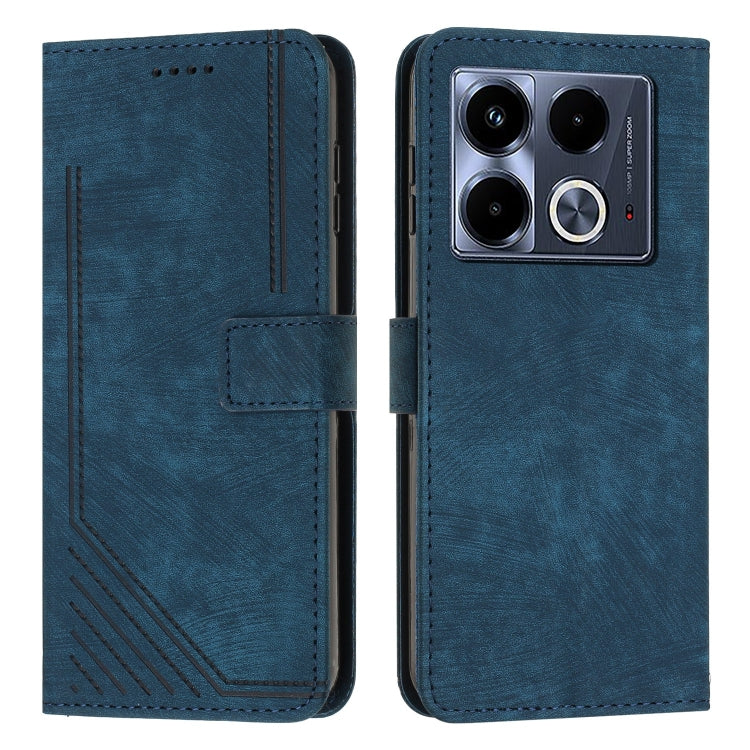 For Infinix Note 40 4G Skin Feel Stripe Pattern Leather Phone Case with Lanyard(Blue) - Infinix Cases by PMC Jewellery | Online Shopping South Africa | PMC Jewellery | Buy Now Pay Later Mobicred