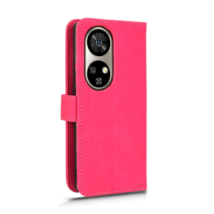 For Ulefone Note 17 Pro Skin Feel Magnetic Flip Leather Phone Case(Rose Red) - Ulefone Cases by PMC Jewellery | Online Shopping South Africa | PMC Jewellery | Buy Now Pay Later Mobicred