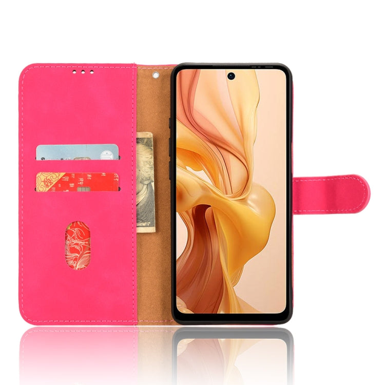 For Ulefone Note 18 Ultra Skin Feel Magnetic Flip Leather Phone Case(Rose Red) - Ulefone Cases by PMC Jewellery | Online Shopping South Africa | PMC Jewellery | Buy Now Pay Later Mobicred