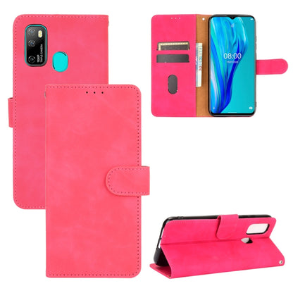 For Ulefone Note 9P Solid Color Skin Feel Magnetic Buckle Horizontal Flip Calf Texture PU Leather Case with Holder & Card Slots & Wallet(Rose Red) - Ulefone Cases by PMC Jewellery | Online Shopping South Africa | PMC Jewellery | Buy Now Pay Later Mobicred