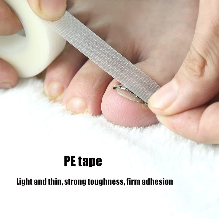 Orthopedic Buckle Toe Nail Groove Ingrown Nail Corrector, Style:No. 36, Specifications:Set - Corrector by PMC Jewellery | Online Shopping South Africa | PMC Jewellery