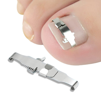 Orthopedic Buckle Toe Nail Groove Ingrown Nail Corrector, Style:No. 36, Specifications:Set - Corrector by PMC Jewellery | Online Shopping South Africa | PMC Jewellery