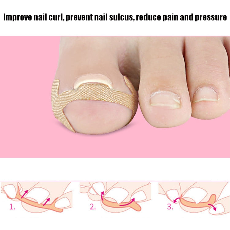 10 Sets Rolled Nail Correction Tape Toe Nail Groove Tape(One size-4 stickers / sheet) - Corrector by PMC Jewellery | Online Shopping South Africa | PMC Jewellery